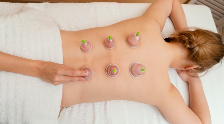 Cupping therapy