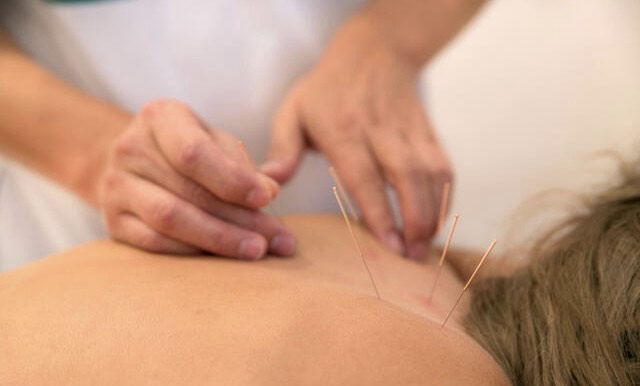 Acupuncture