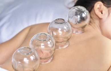 Cupping Therapy In Brisbane