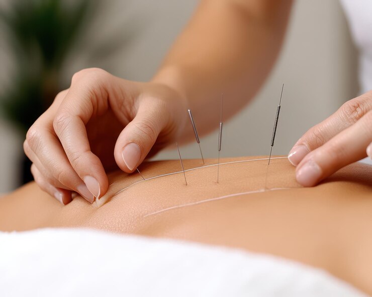 acupuncture-needles-precision-skill-hands-traditional-chinese-medicine-practitioner-practicing_996993-133308